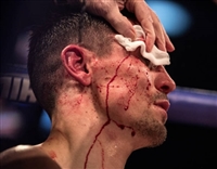 Anthony Crolla tote bag #G1838019