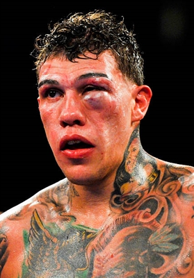 David Lemieux posters